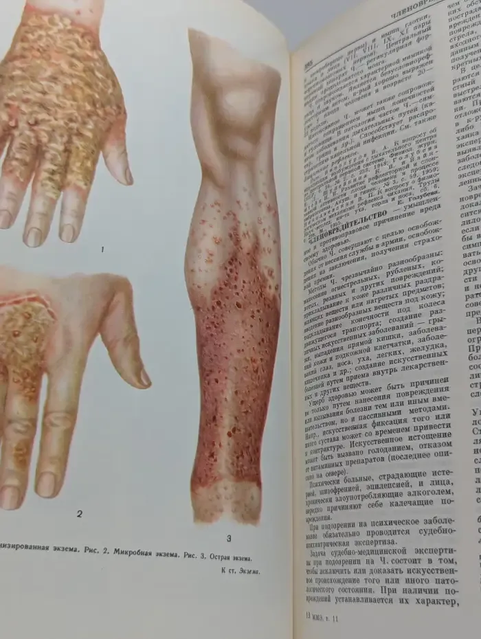 Малая медицинская энциклопедия. Том 11