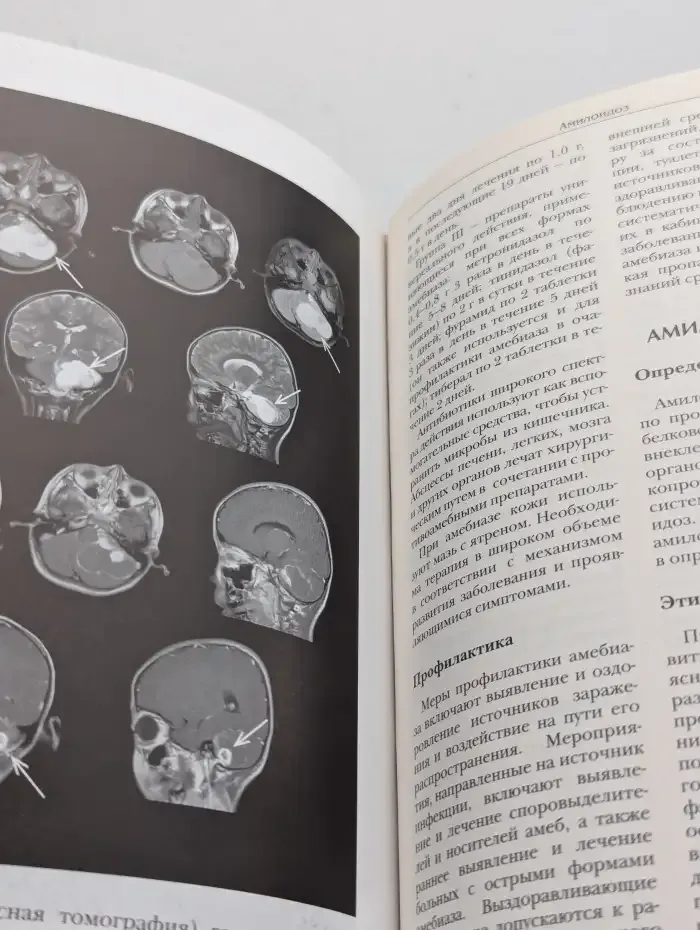 Большая медицинская энциклопедия в 30 томах. Том 1. А - Асф