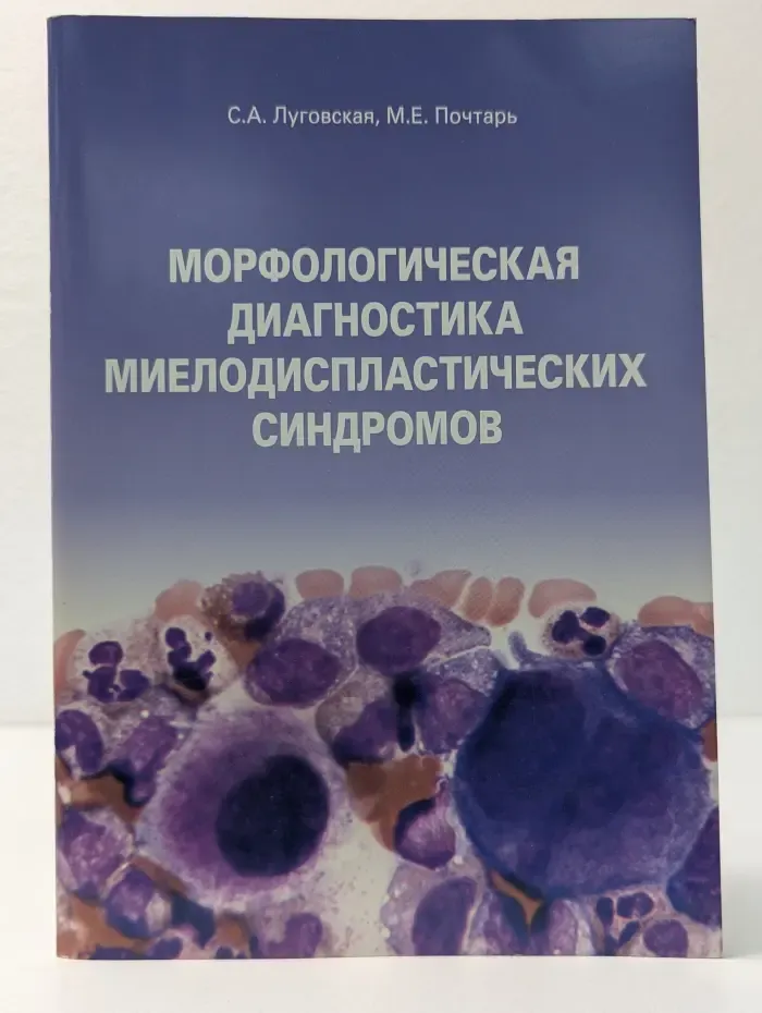 Морфологическая диагностика миелодиспластических синдромов
